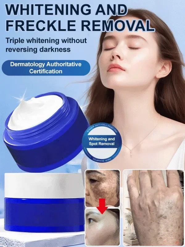 đ„- ăGamla flĂ€ckar och gula flĂ€ckar försvinneră Spot Fading Urea Cream