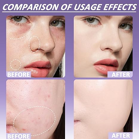 🔥 SISTA DAGEN 49 % RABATT 🔥 Soft Matte Cream Concealer