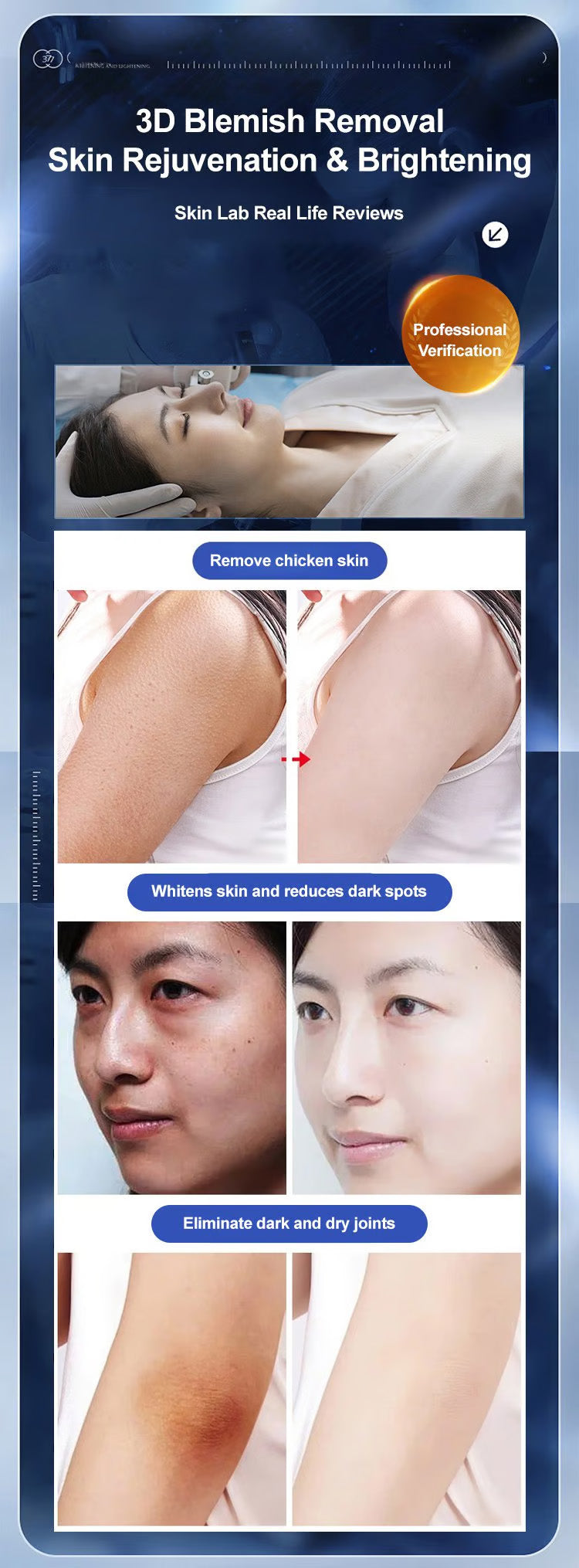 🔥- 【Gamla fläckar och gula fläckar försvinner】 Spot Fading Urea Cream