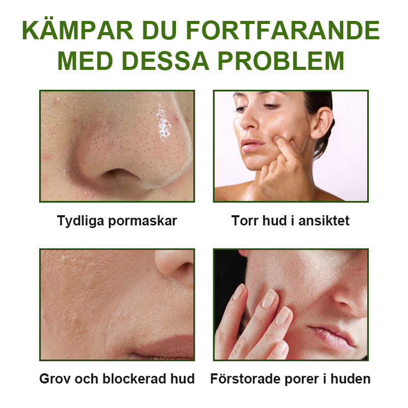 🌸Ansiktsrengörande Lermask